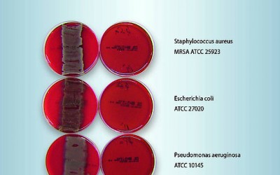 Germ-killing effect for cables